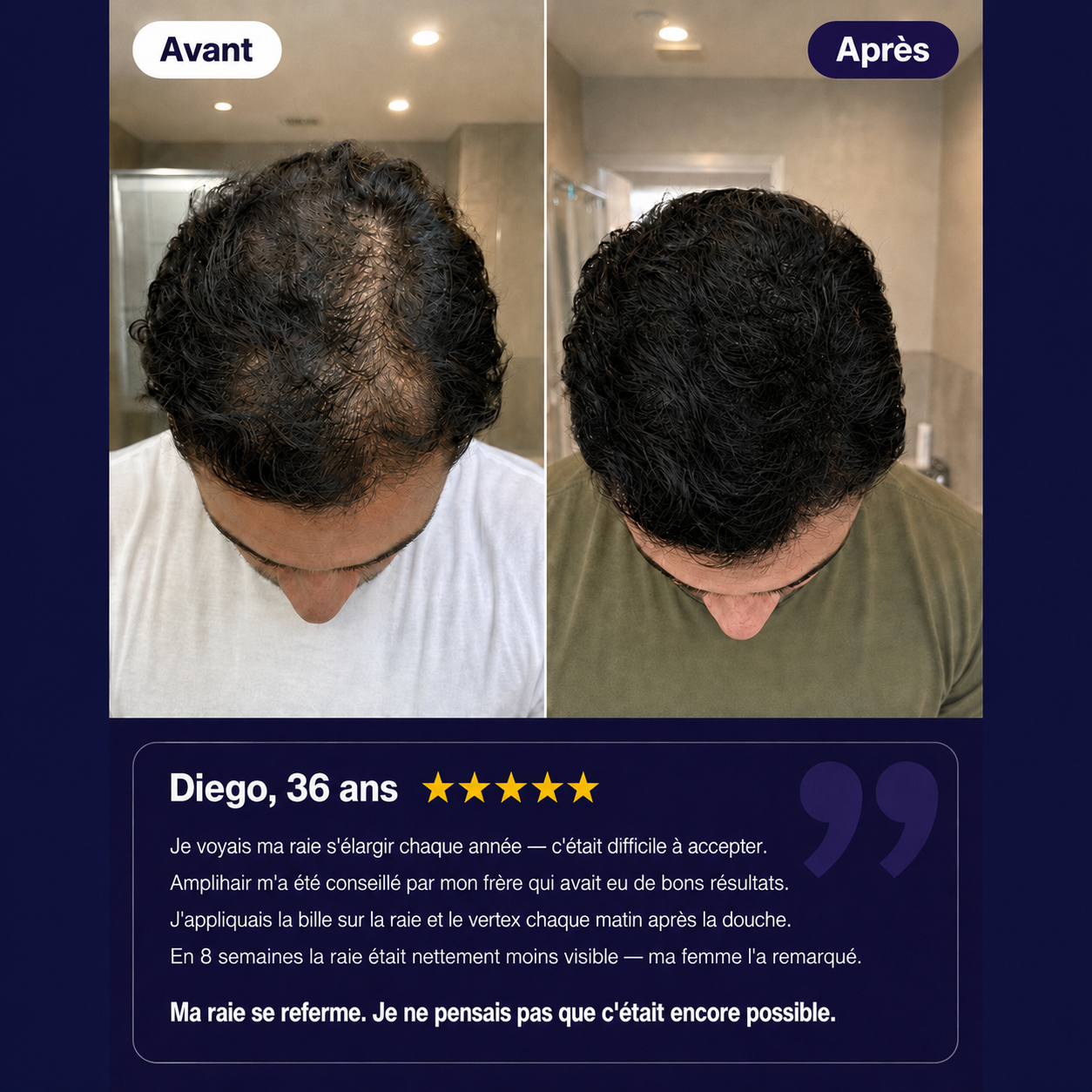 Amplihair -Sérum Repousse