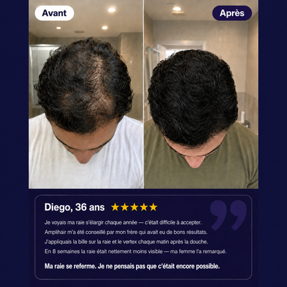 Sérum Amplihair — vos cheveux repoussent en 30 jours.